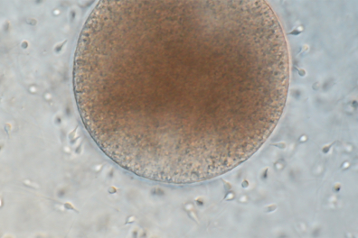 Fécondation chez la Moule - spermatozoïdes autour d'un ovule x200